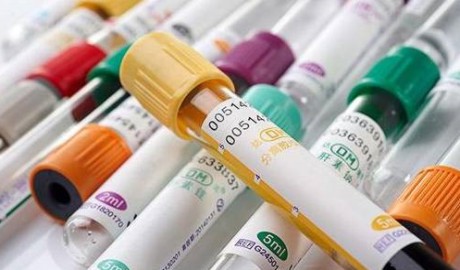 采血管內壁促凝劑/抗凝（níng）劑噴塗